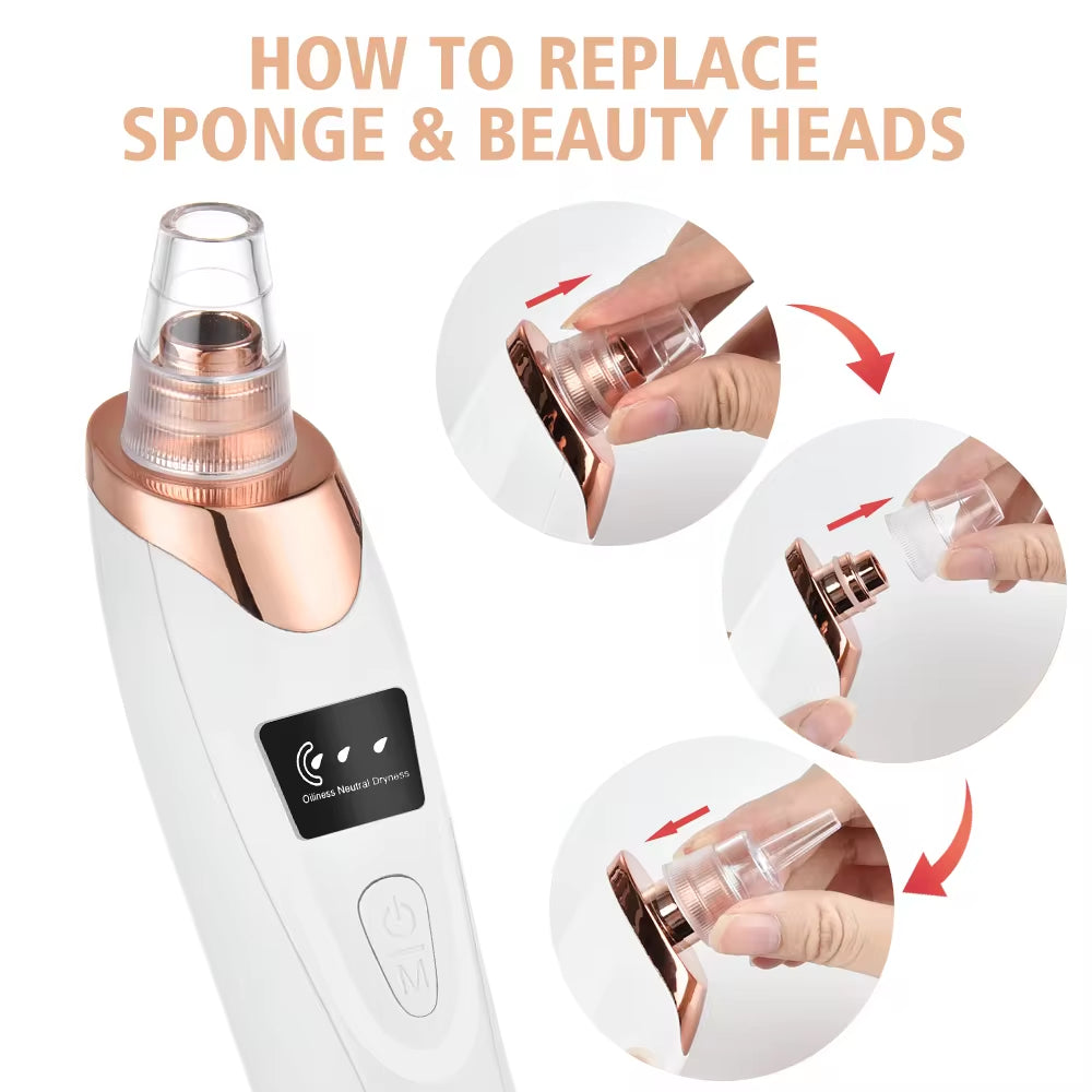 Species ABFA Electric Blackhead Remover Vacuum 