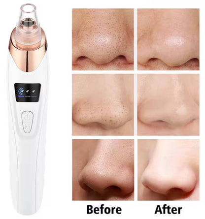 SPECIES Electric Blackhead Remover Vacuum