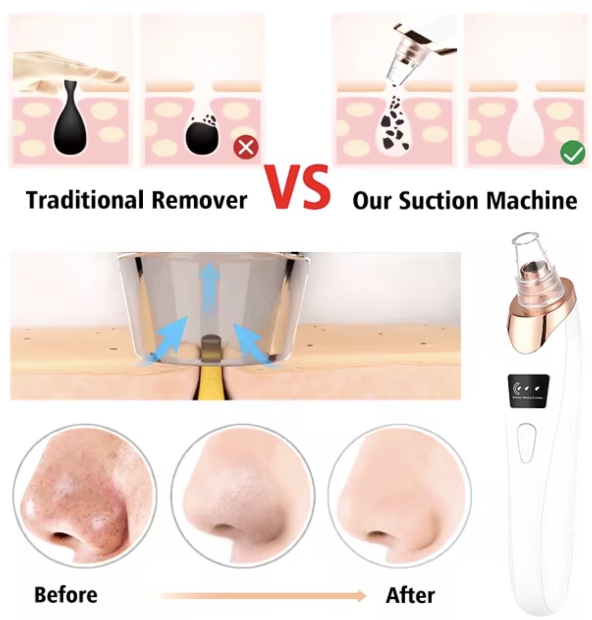 SPECIES Electric Blackhead Remover Vacuum